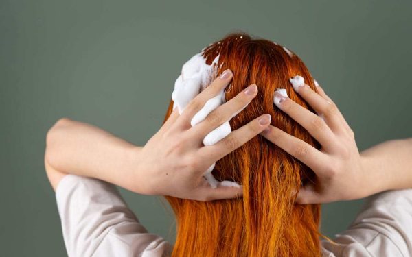 Cum pot preveni mâncărimea scalpului