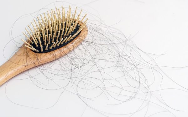 Care sunt semnele că pierderea părului necesită consult dermatologic urgent?